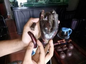 Một phần tay bị gãy do vụ trộm